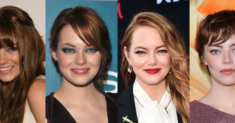 Emma Stone fez lifting facial Antes e depois em 35